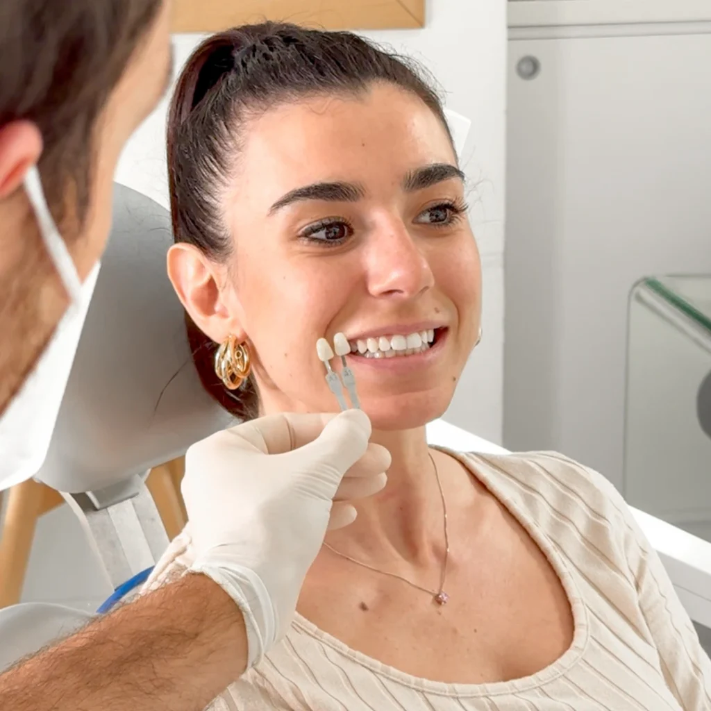 Faccette dentali a Roma EUR