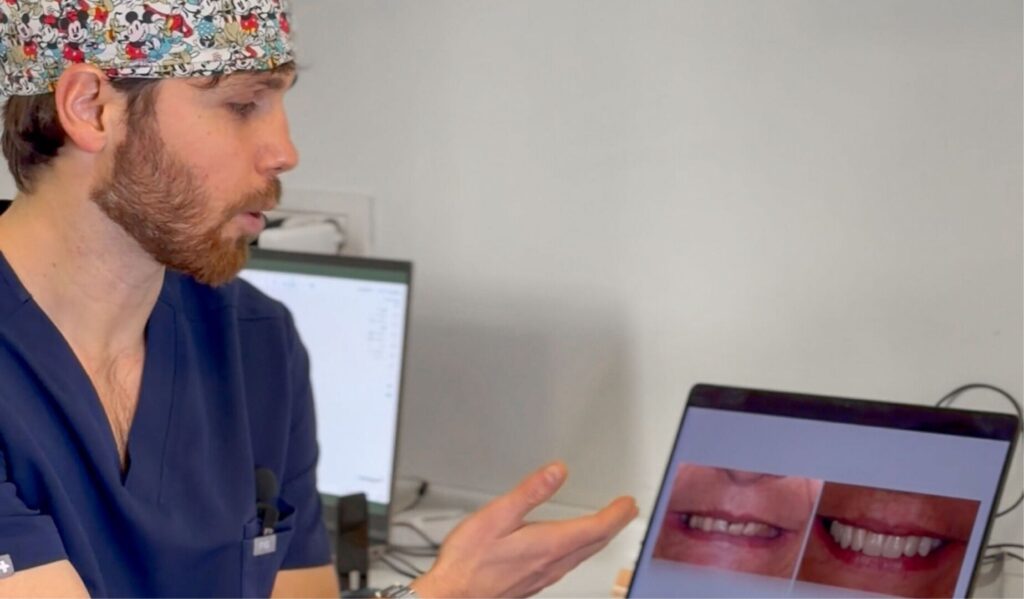 Come alleviare il dolore dopo un impianto dentale: la guida per una guarigione serena 1 come alleviare il dolore dopo un impianto dentale