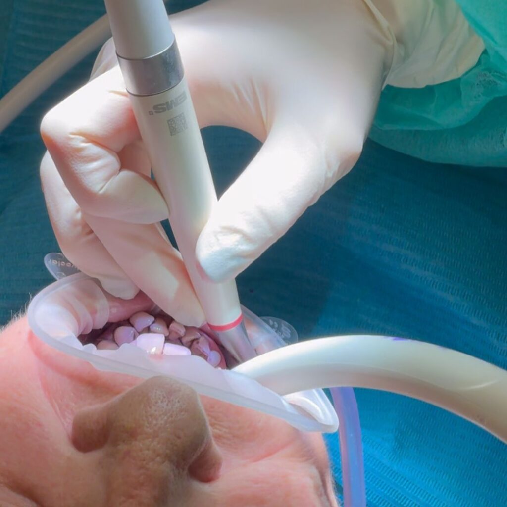 Igiene Orale 1 Igiene dentale a Roma EUR